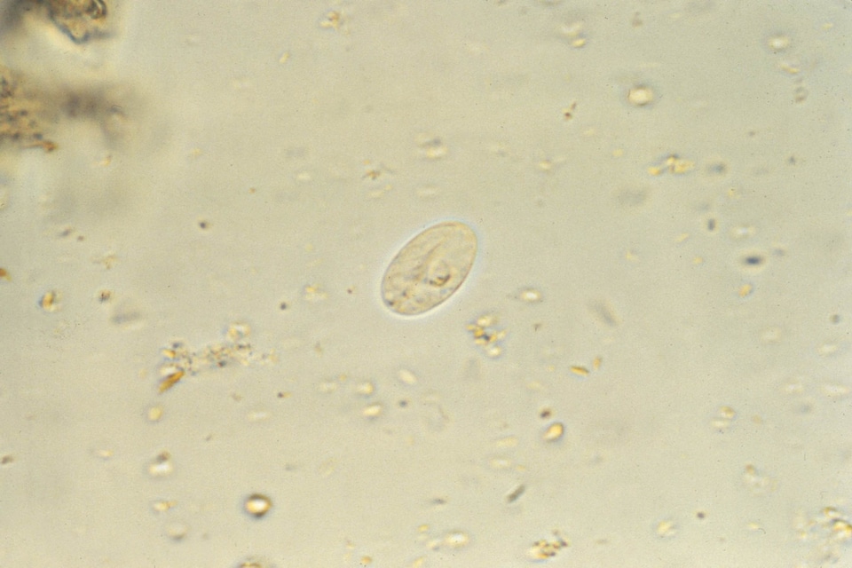 Giardia iodine parasit
