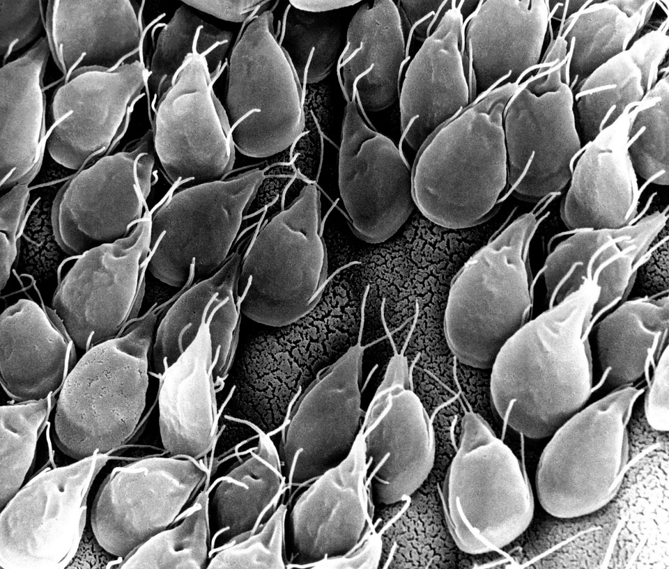 Electron Micrograph gerbil giardia