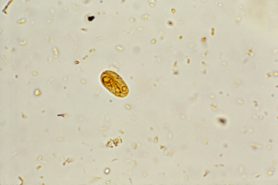 Coloration cyst giardia