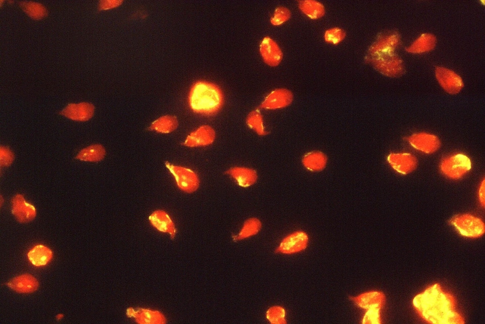 Giardia immunofluorescence proof