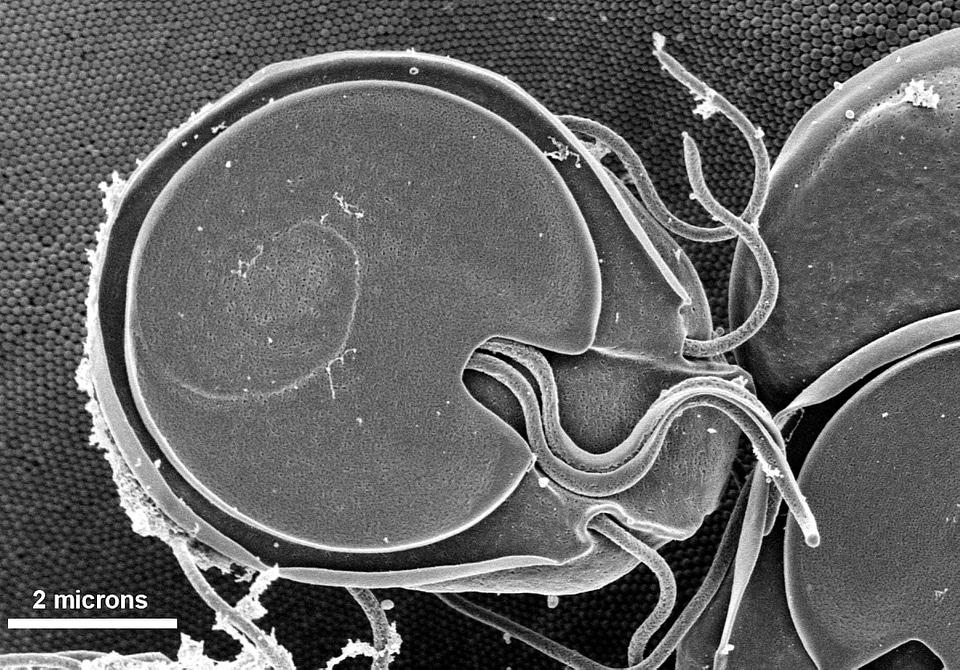 Giardia intestine surface