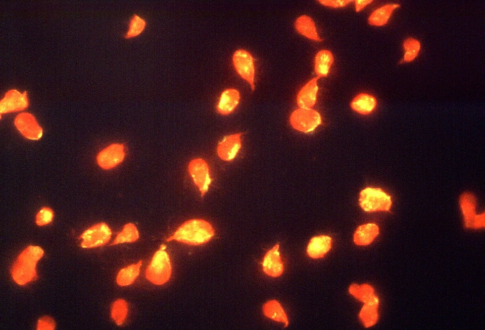 Common giardia longer