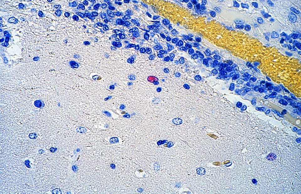Infection photomicrograph virus