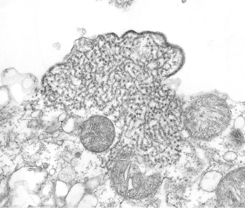 Adult disease malaysia