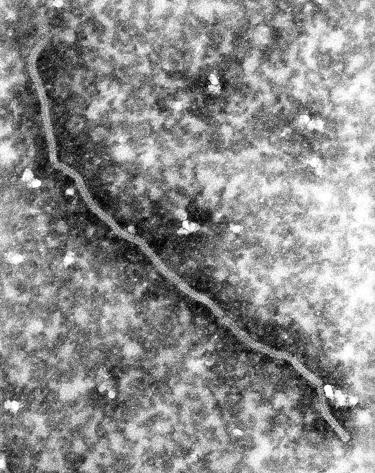 Details image ultrastructural