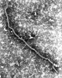 Details image ultrastructural