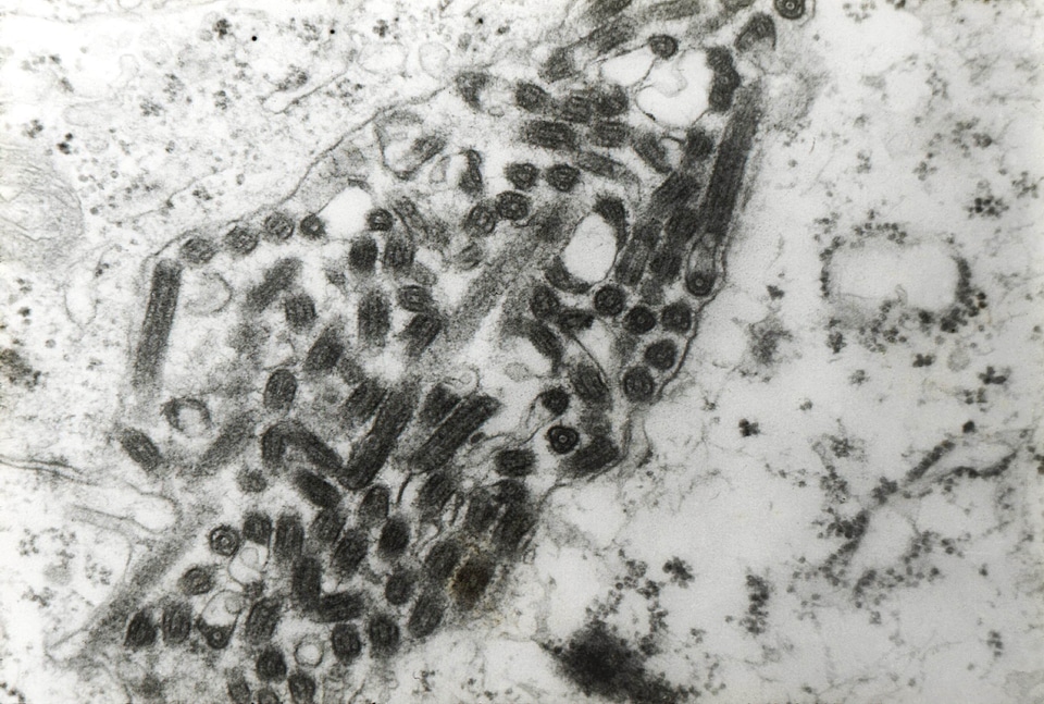 Fever hemorrhagic fever 