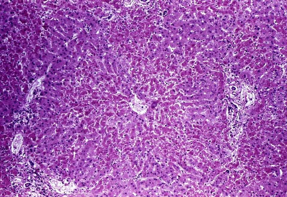 Liver photomicrograph 