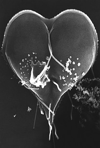 Giardia protozoan separate