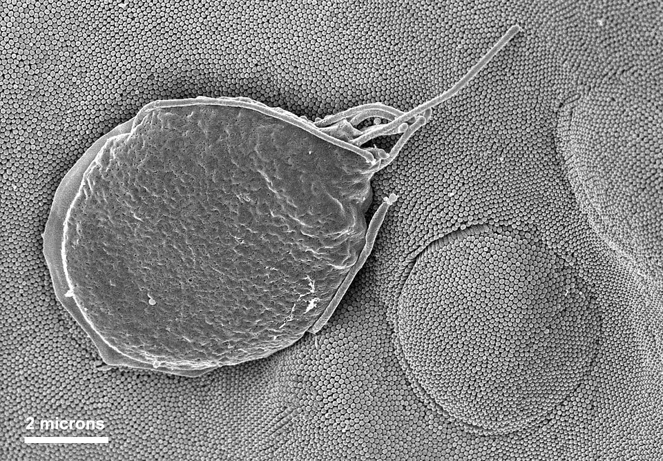 Border cell epithelial cell