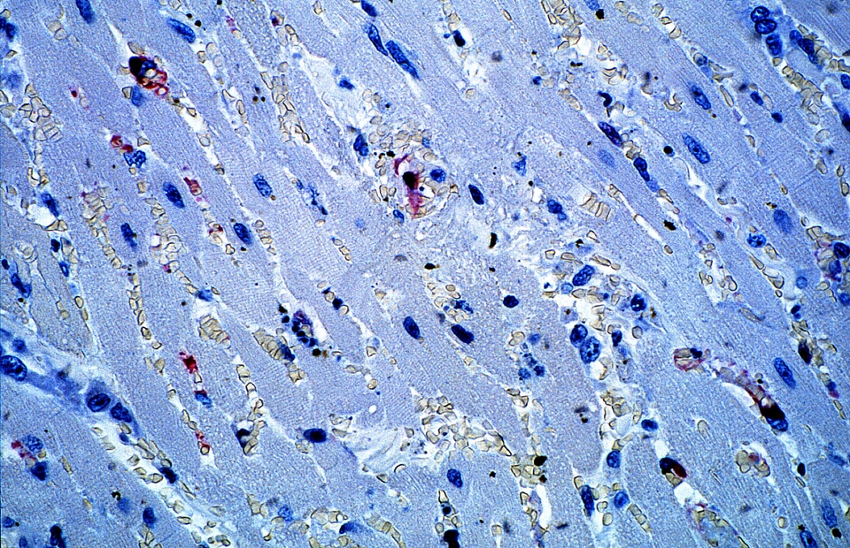 Antibody detection virus