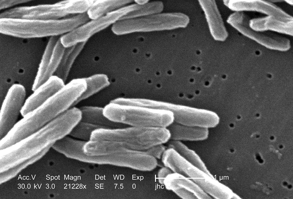 Aerobe environment organism