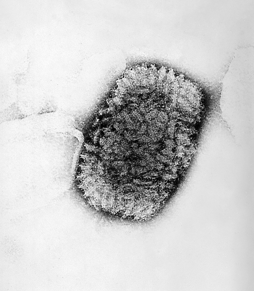 Close close-up electron