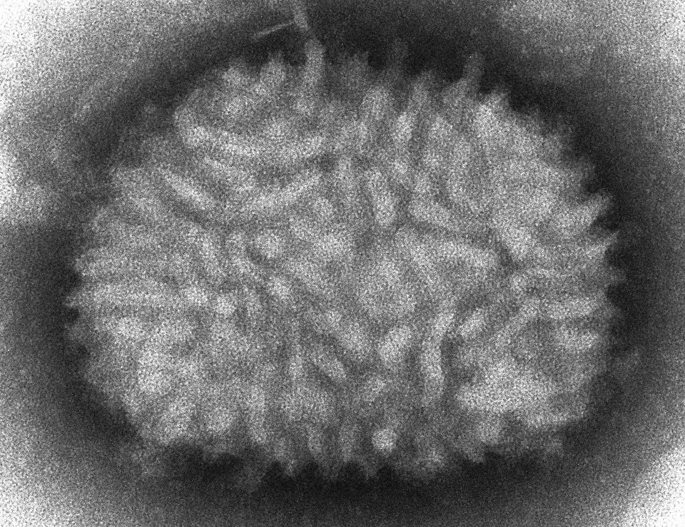 Electron electron micrograph vaccinia