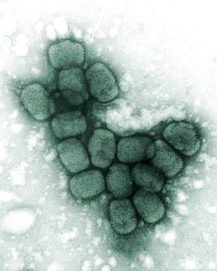 Broadcast electron micrograph labor