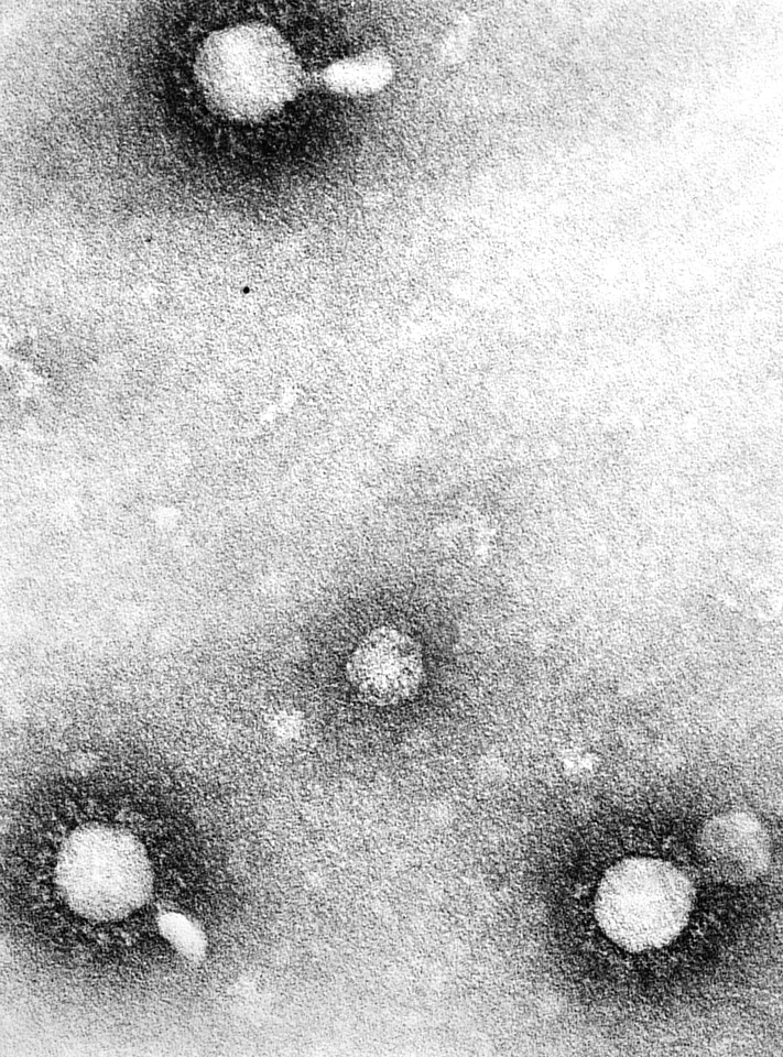 Equine equine encephalitis number
