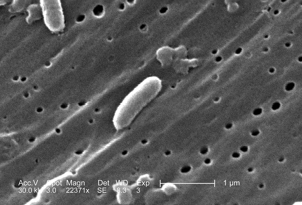 Bacteria number vibrio