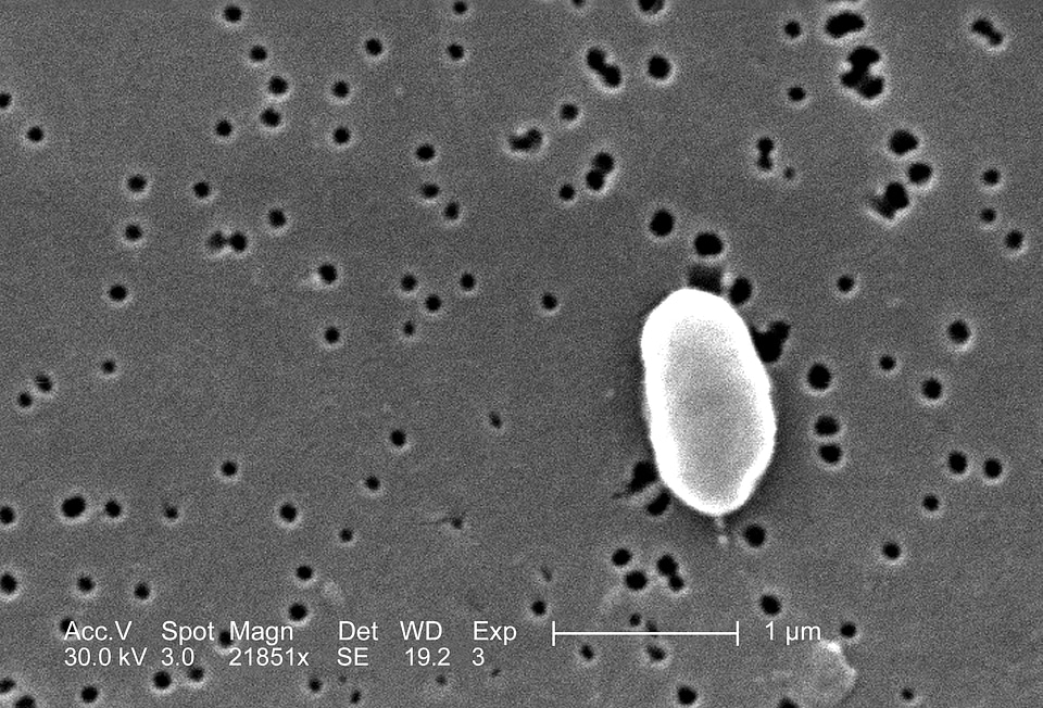 Electron electron micrograph vibrio