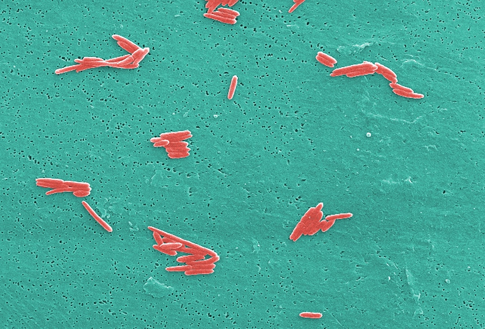 Bacteria gram negative