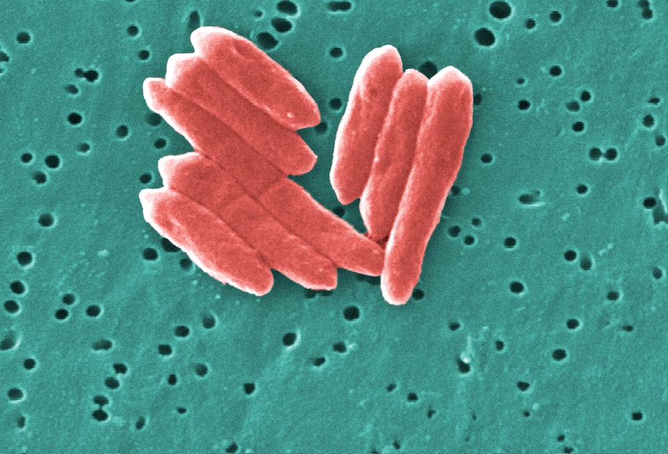 Bacteria gram grouping