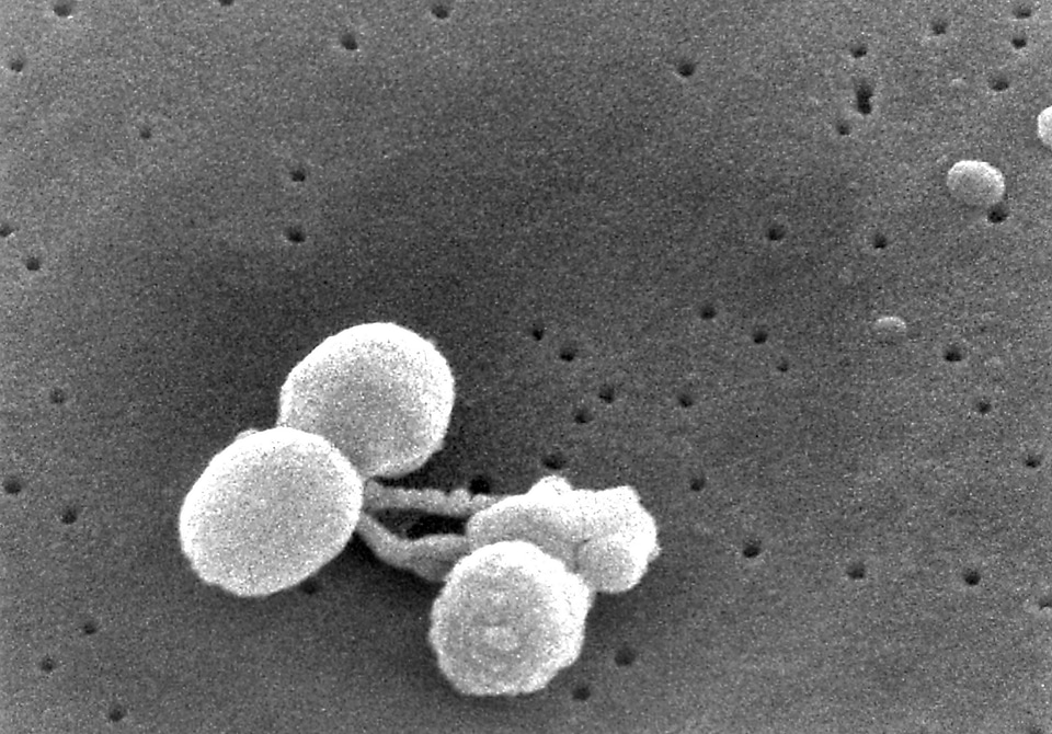 Bacteria gram number