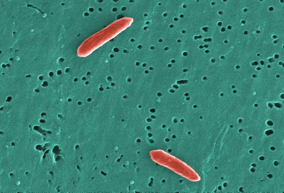 Bacteria gram negative