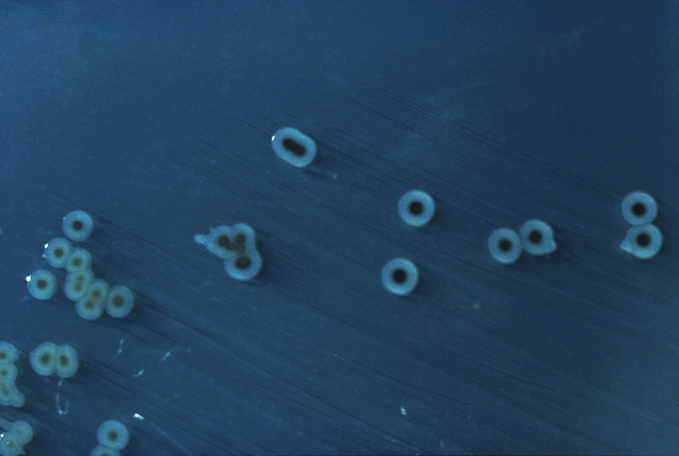 Bacteria colonial growth
