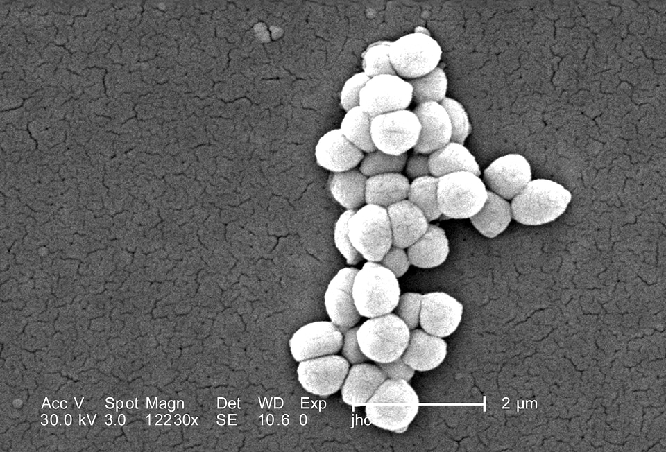 Bacteria electron electron micrograph