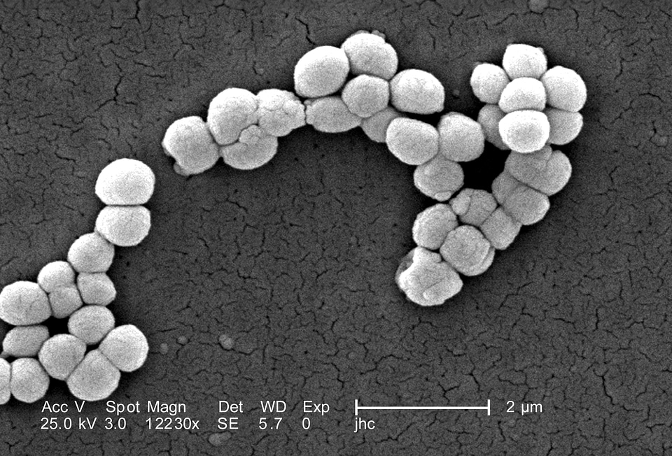 Bacteria gram magnification