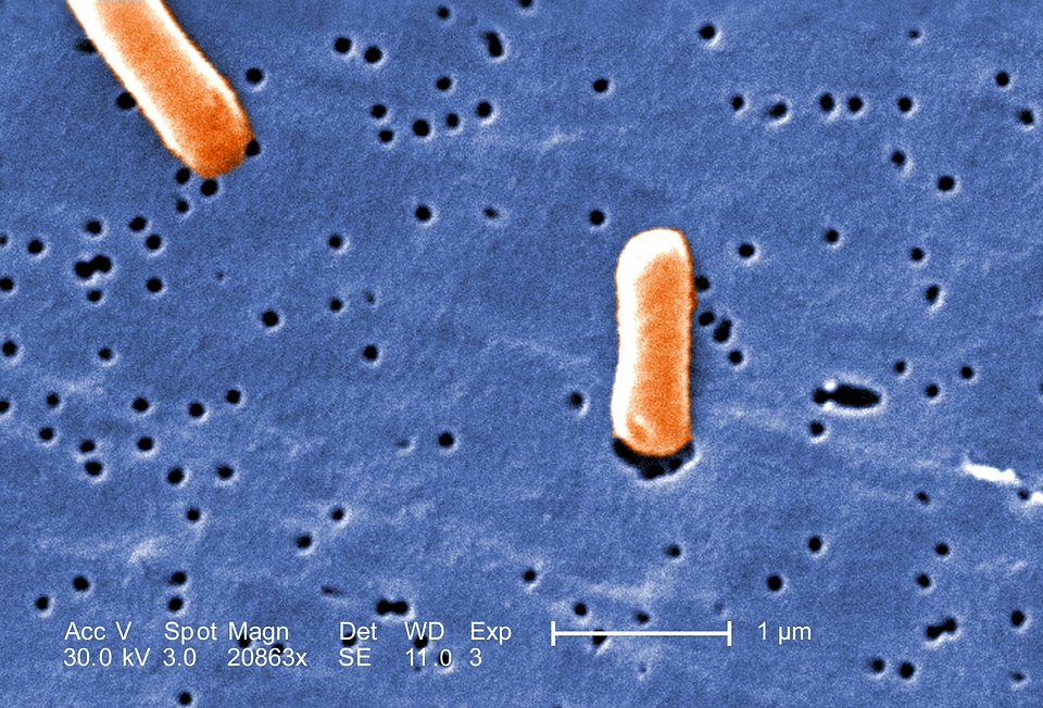 Close close-up salmonella