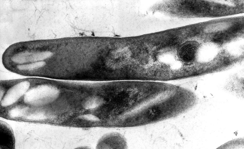 Agent gram positive photo