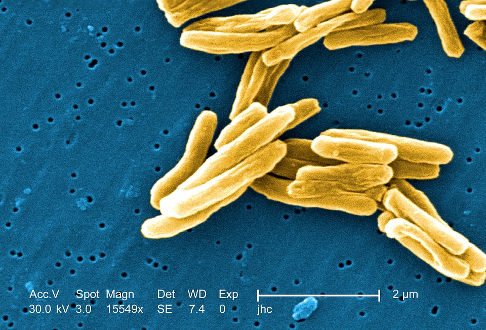 Bacteria gram positive