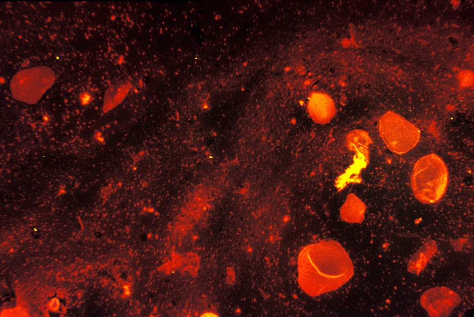 Bacteria light microscopy