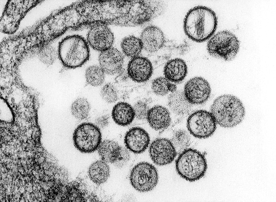 Virus  