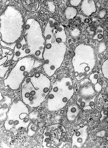 Canada electron electron micrograph photo