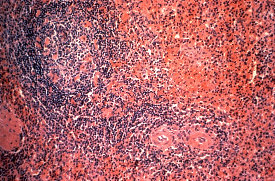 Evening histopathology note