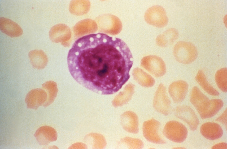 Blood cervical smear found