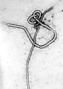 Morphology ultrastructural virion photo