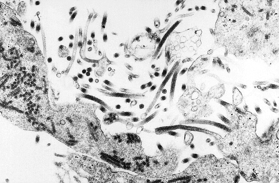Morphologic ultrastructural virus