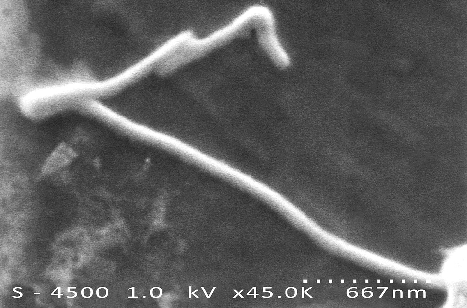 Morphologic ultrastructural virus