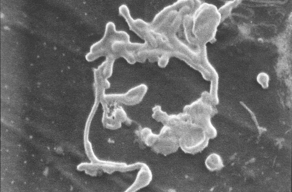 Fever hemorrhagic fever 