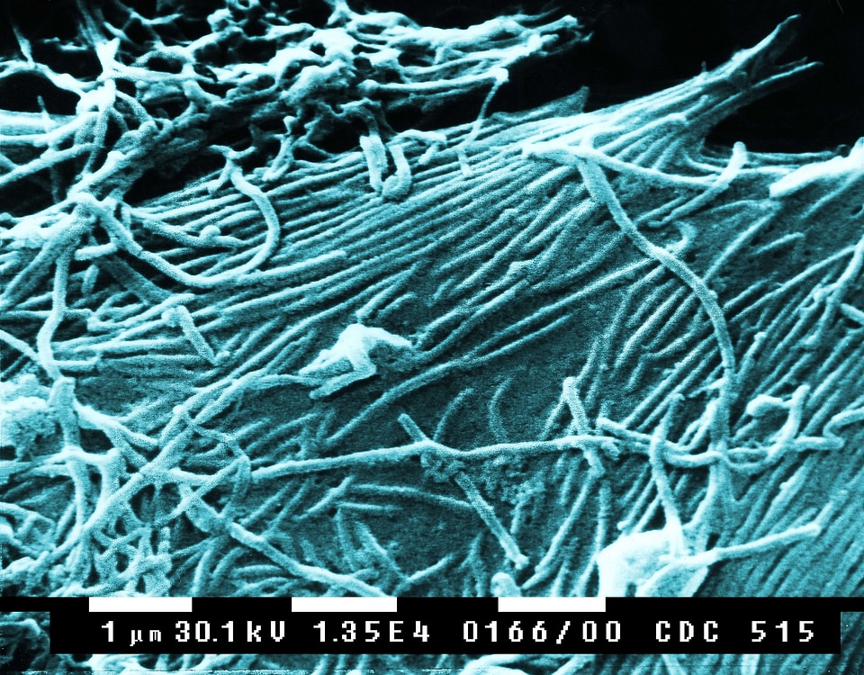 Fever hemorrhagic fever 