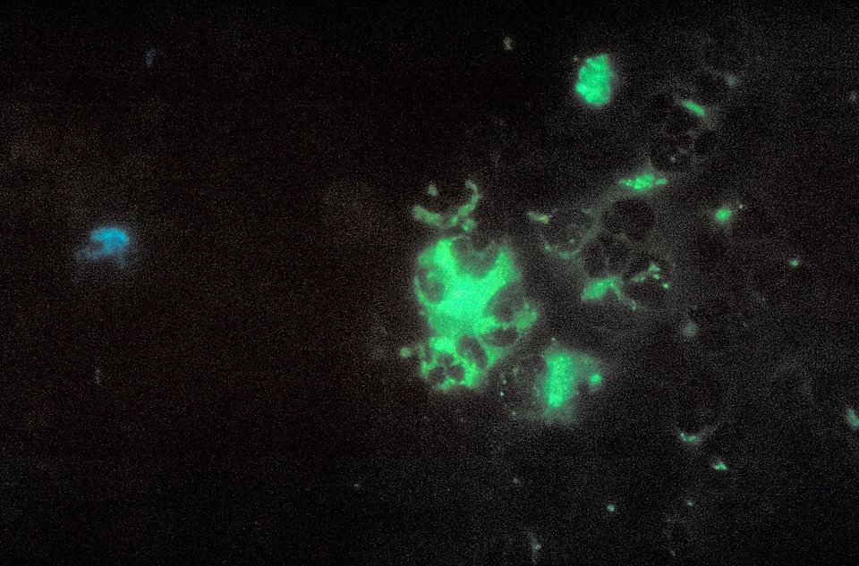 Brain cervical smear impression