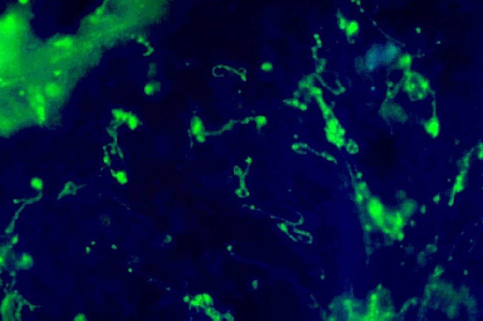 Bacteria cervical smear impression