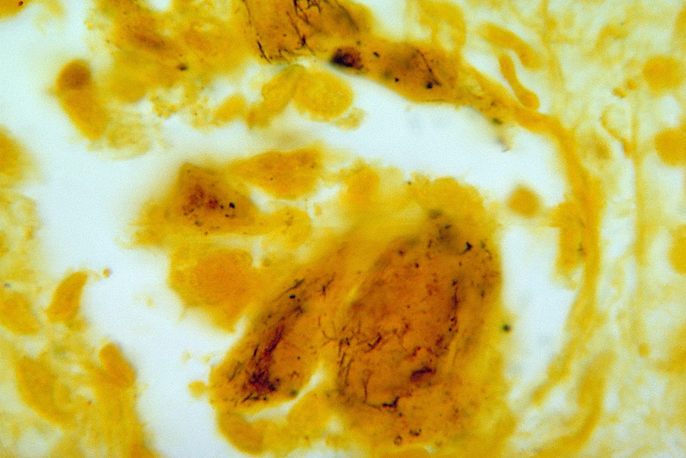 Bacteria coloration leptospira