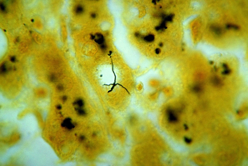 Bacteria leptospira liver photo