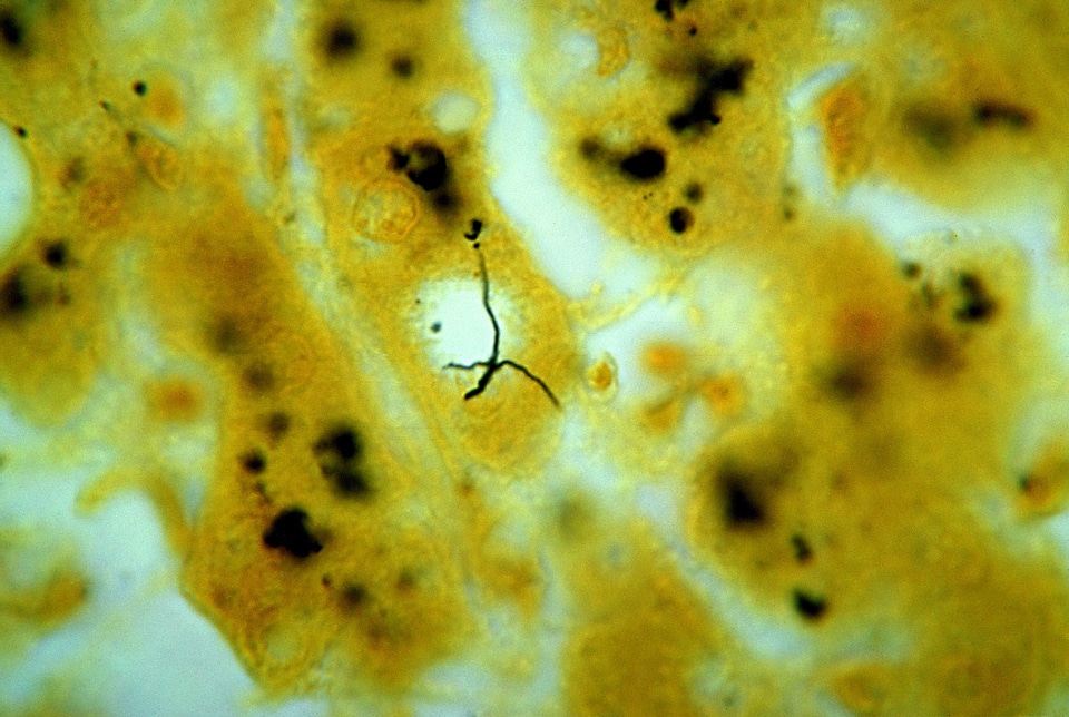 Bacteria leptospira liver