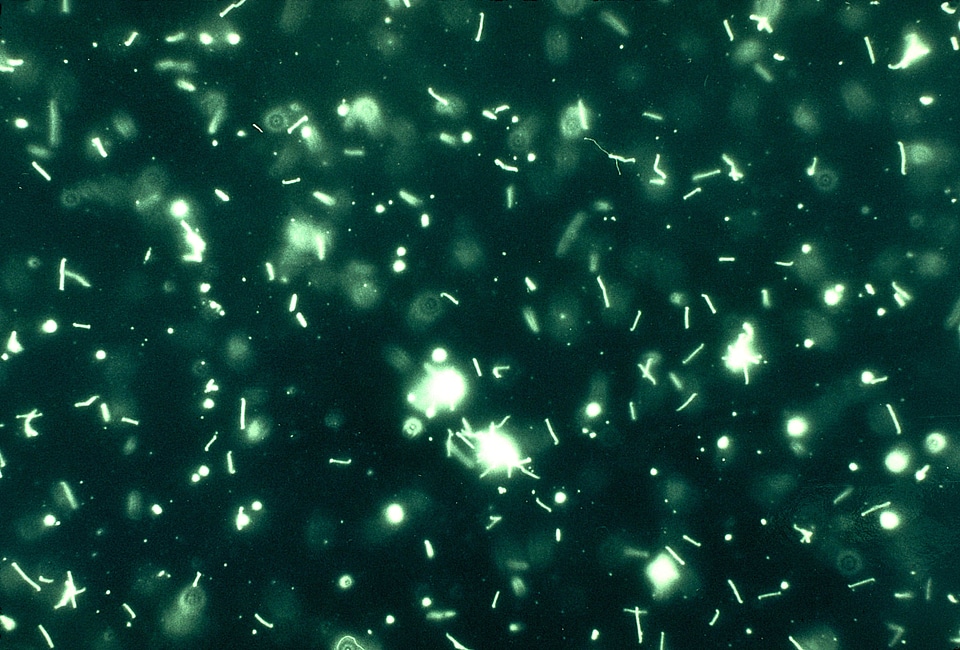 Common disease global