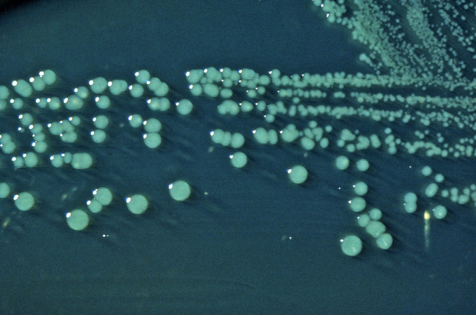 Bacteria shigella surface