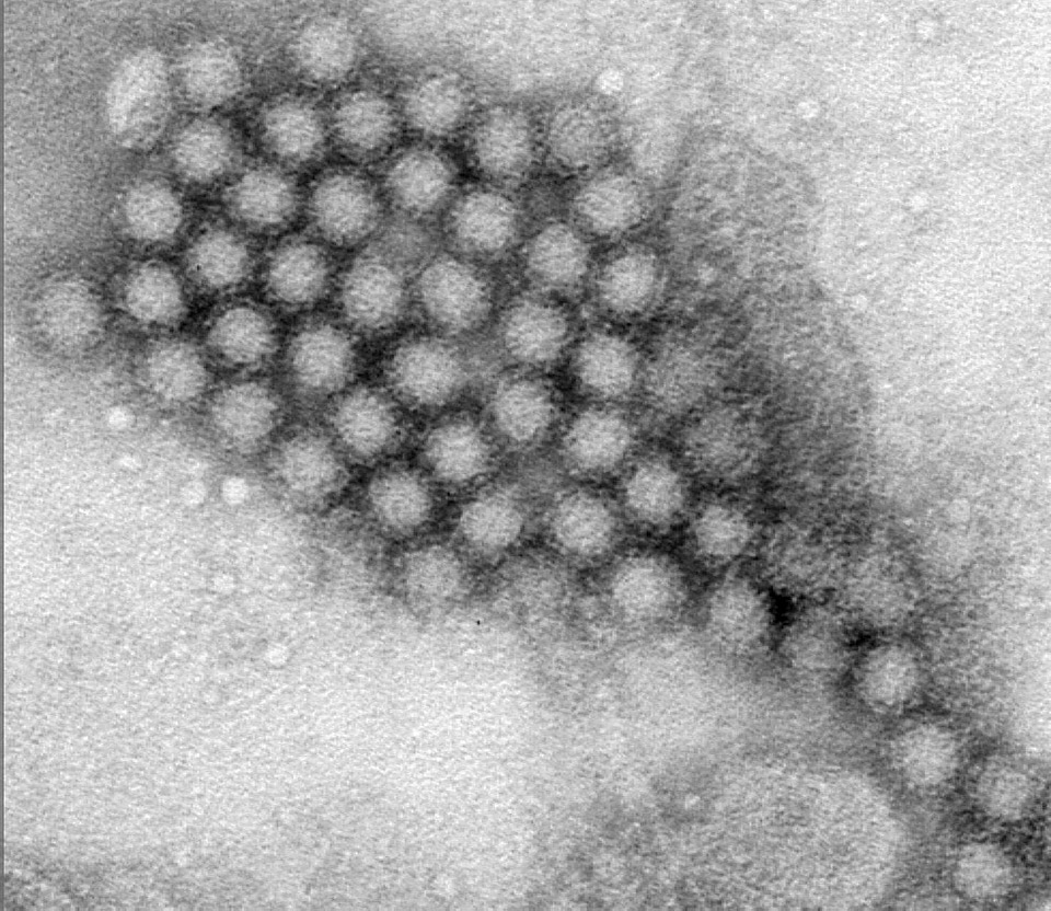Belly diarrhea disease